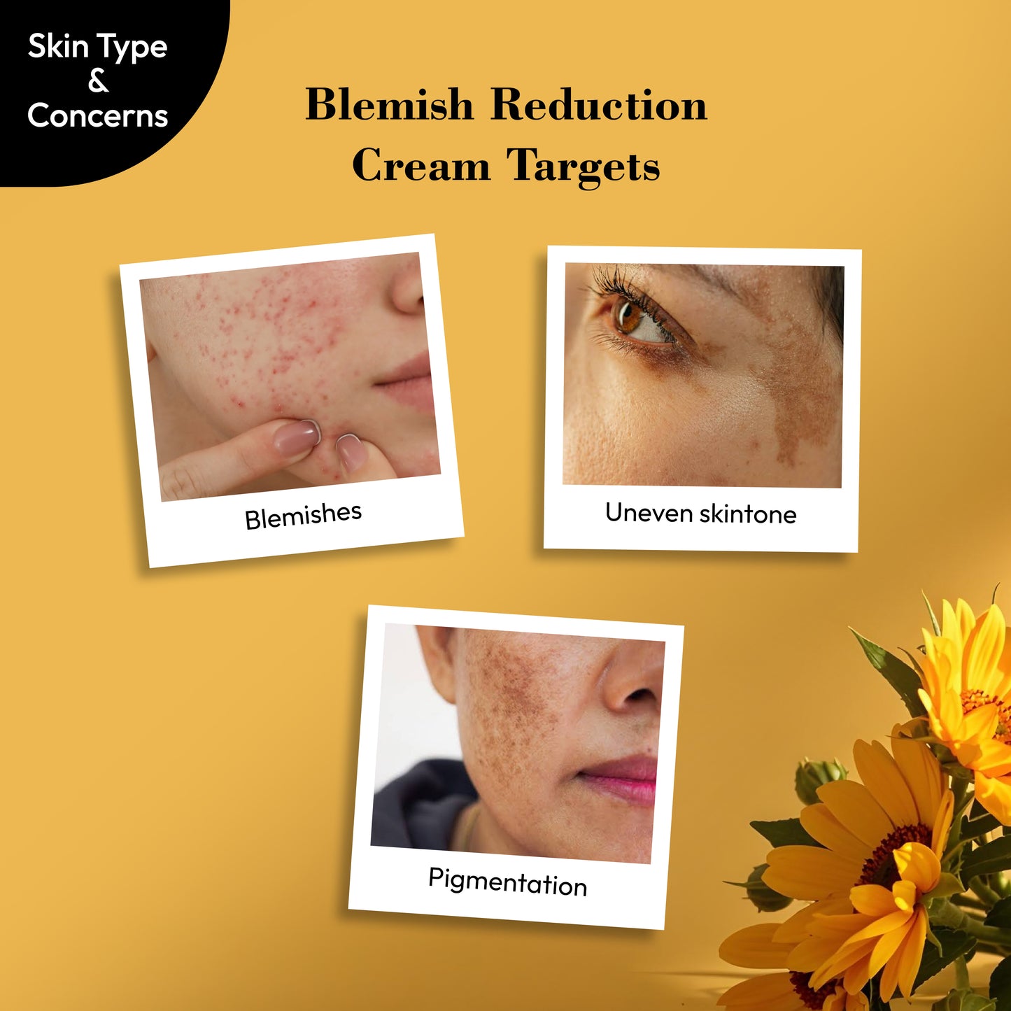 Blemish Reduction Cream 50gm