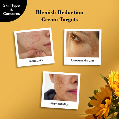 Blemish Reduction Cream 50gm